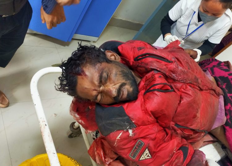দলদলীত ৰেলৰ চেঁপাত এজনৰ কৰুণ মৃত্যু: 1 দলদলীত ৰেলৰ চেঁপাত এজনৰ কৰুণ মৃত্যু: