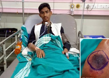 সাপ ধৰি খেলি আছিল এজন যুৱকে, তাৰ পিছত ঘটিল এই ভয়ংকৰ ঘটনা…