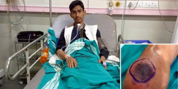 সাপ ধৰি খেলি আছিল এজন যুৱকে, তাৰ পিছত ঘটিল এই ভয়ংকৰ ঘটনা…