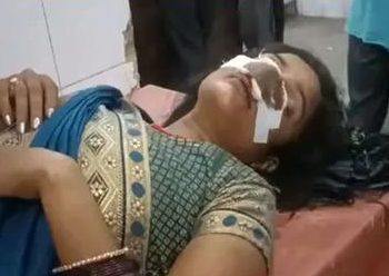 উত্তৰ প্ৰদেশৰ বাহৰাইচত সংঘটিত এক আজৱ কাণ্ডঃ পত্নীৰ নাক কামুৰি চিঙি পেলালে স্বামীয়ে: