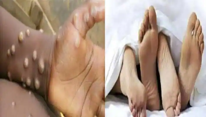 সঘনাই যৌন সঙ্গী সলনি নকৰিব