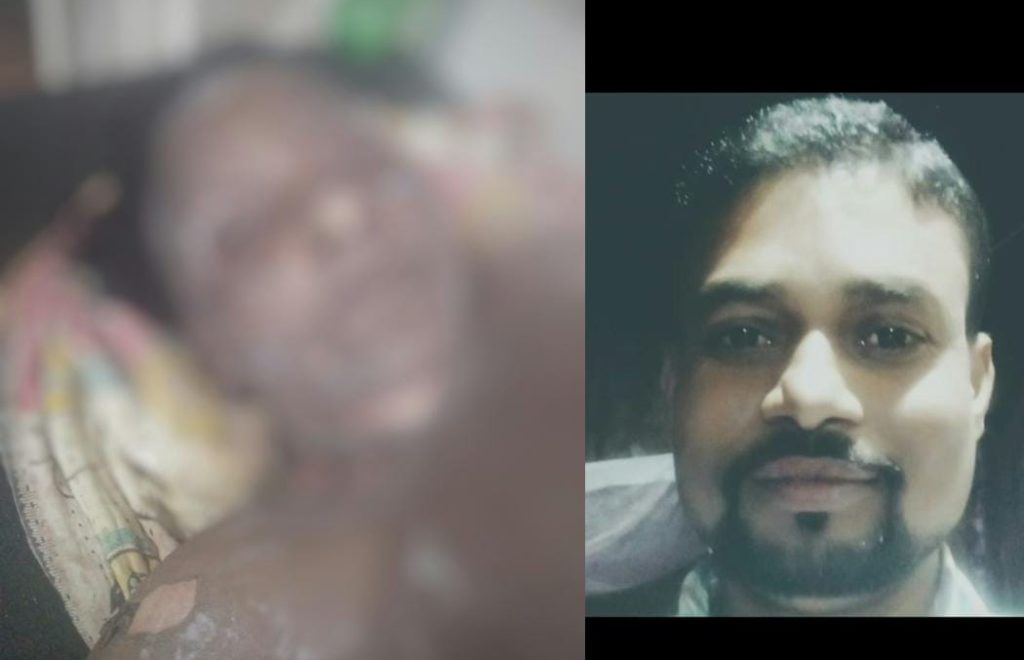 যৌতুকৰ ধন নিদিয়াৰ স্বামীয়ে পেট্ৰল ঢালি জ্বলালে পত্নীকঃ