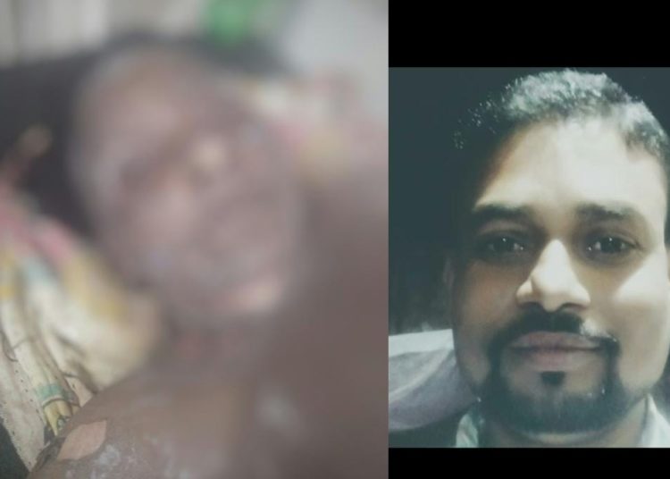 যৌতুকৰ ধন নিদিয়াৰ স্বামীয়ে পেট্ৰল ঢালি জ্বলালে পত্নীকঃ