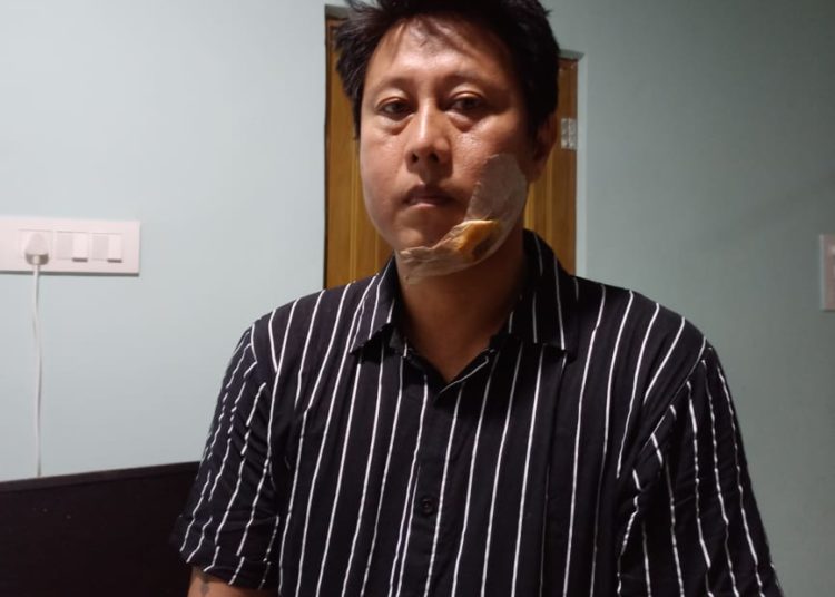 ডিফু আৰু বোকাজান আৰক্ষীৰ জালত পেছাদাী নগা চোৰ: