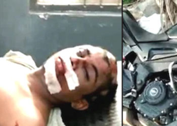 শিমলাগুৰিত মহিলাৰ পৰা টকাৰ বেগ কাঢ়িবলৈ লওঁতেই দুৰ্ঘটনাত প্ৰাণ গ’ল চিলনী চোৰৰ, আঘাতপ্ৰাপ্ত এজনঃ
