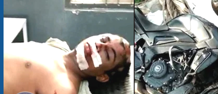 শিমলাগুৰিত মহিলাৰ পৰা টকাৰ বেগ কাঢ়িবলৈ লওঁতেই দুৰ্ঘটনাত প্ৰাণ গ'ল চিলনী চোৰৰ, আঘাতপ্ৰাপ্ত এজনঃ 1 শিমলাগুৰিত মহিলাৰ পৰা টকাৰ বেগ কাঢ়িবলৈ লওঁতেই দুৰ্ঘটনাত প্ৰাণ গ’ল চিলনী চোৰৰ, আঘাতপ্ৰাপ্ত এজনঃ