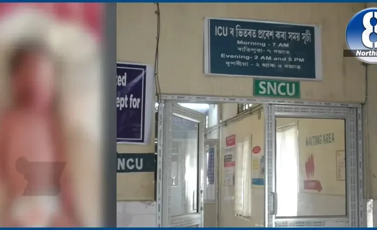 মঙ্গলদৈ অসামৰিক চিকিৎসালয়ত আন এক অঘটনঃ নৱজাতকৰ গাত নাৰ্চে পেলালে গৰম তেল