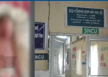 মঙ্গলদৈ অসামৰিক চিকিৎসালয়ত আন এক অঘটনঃ নৱজাতকৰ গাত নাৰ্চে পেলালে গৰম তেল