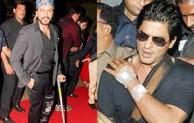 SRK Gets Badly Injured On Sets I শ্বুটিঙত গুৰুতৰভাৱে আহত শ্বাহৰুখ খান! আমেৰিকাত অস্ত্ৰোপচাৰ