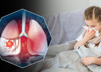 White Lung Syndrome : শিশুৰ মাজত বিয়পি পৰিছে আন এক ৰোগ, আপোনাৰ শিশুটিক কেনেদৰে সুস্থ কৰি ৰাখিব?