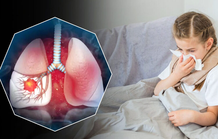 White Lung Syndrome : শিশুৰ মাজত বিয়পি পৰিছে আন এক ৰোগ, আপোনাৰ শিশুটিক কেনেদৰে সুস্থ কৰি ৰাখিব?