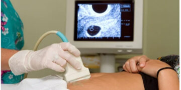 Fetus in fetu : আচৰিত ঘটনাত স্তম্ভিত চিকিৎসক, ভ্ৰূণৰ ভিতৰত ধৰা পৰিল ভ্ৰূণ