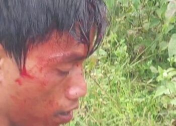 Tragic Clash at Assam-Meghalaya Border: One Dead, Several Injured